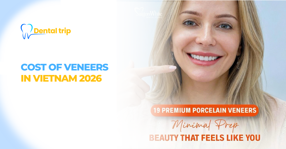 Veneers Cost in Vietnam