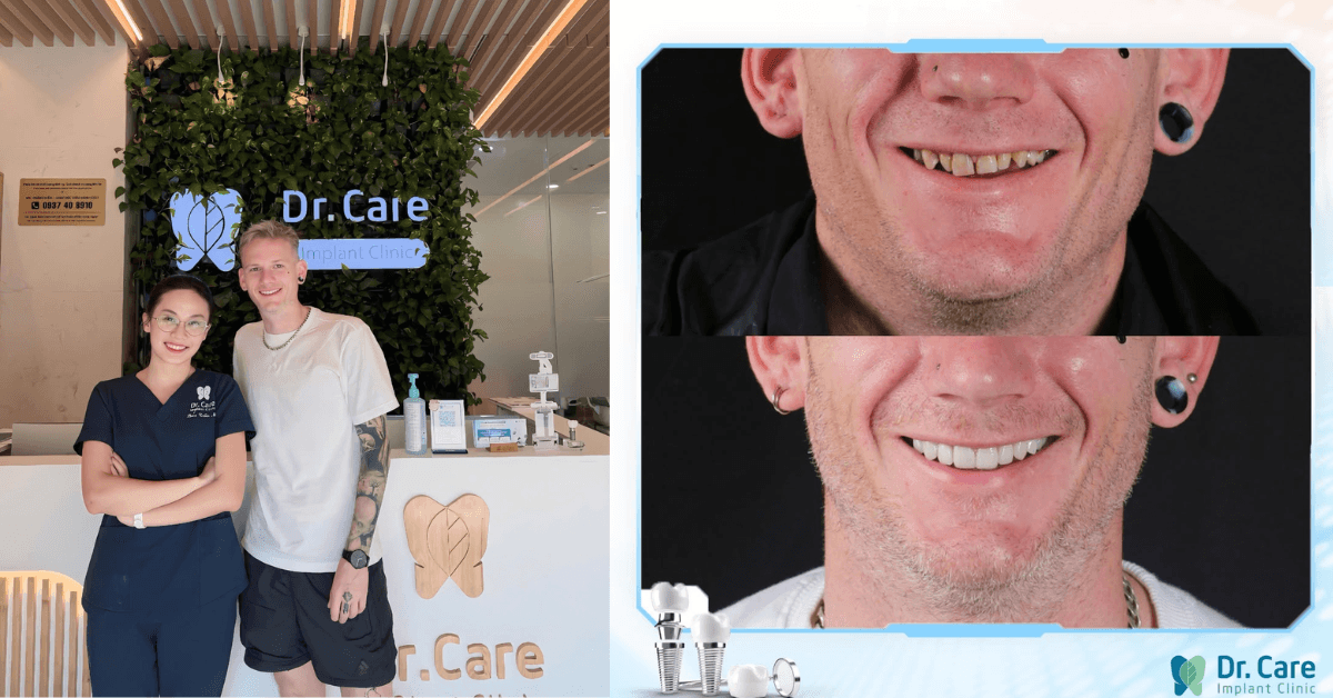 Before after dental treatment