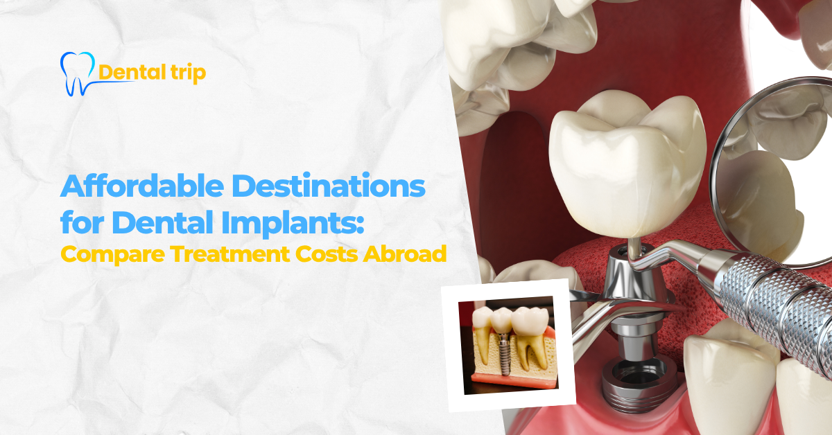 Affordable countries for dental implants in 2026 