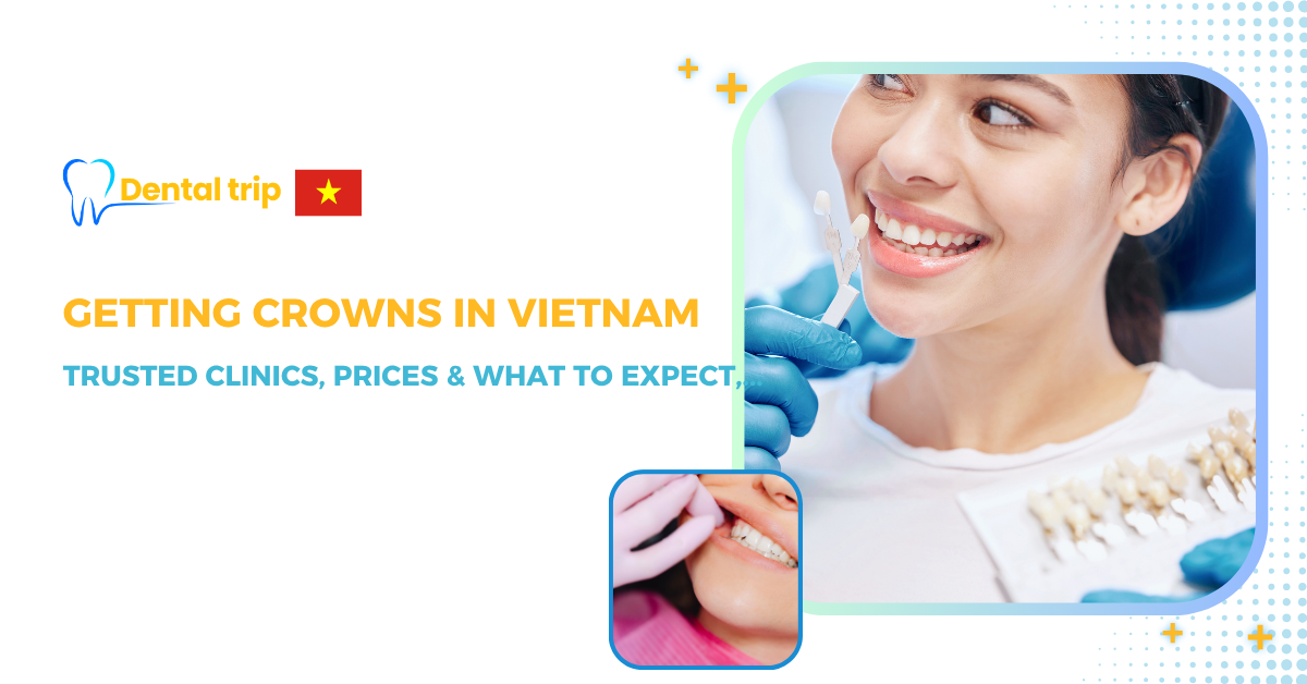 Clinics for dental crowns in Vietnam