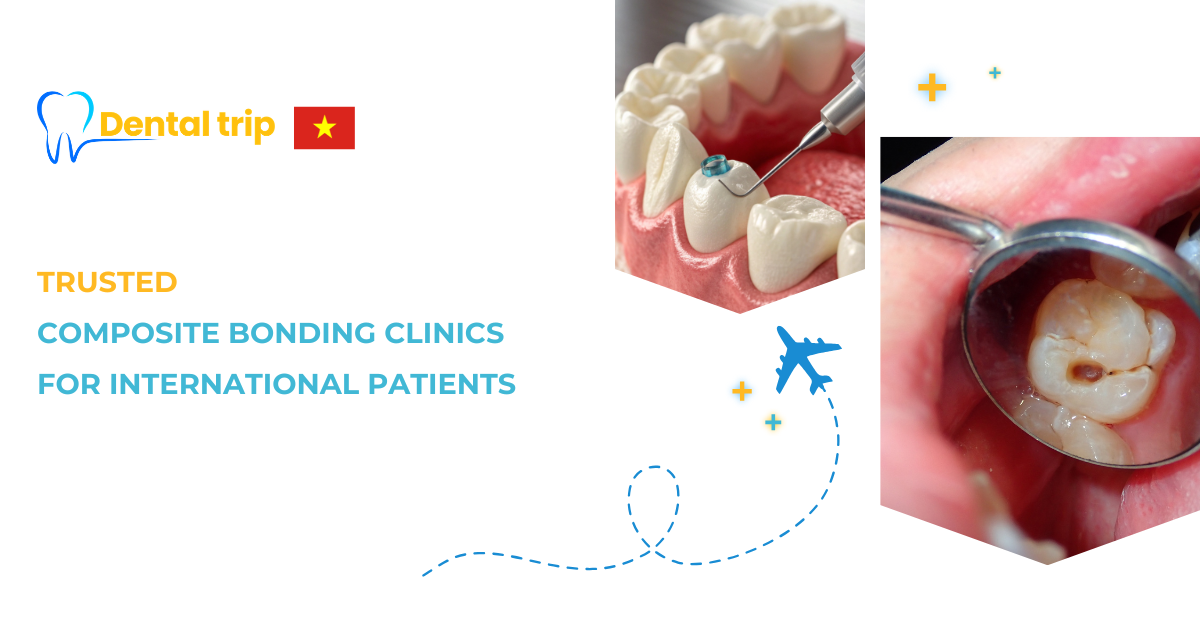 Where to get high-quality dental bonding clinics in Vietnam?