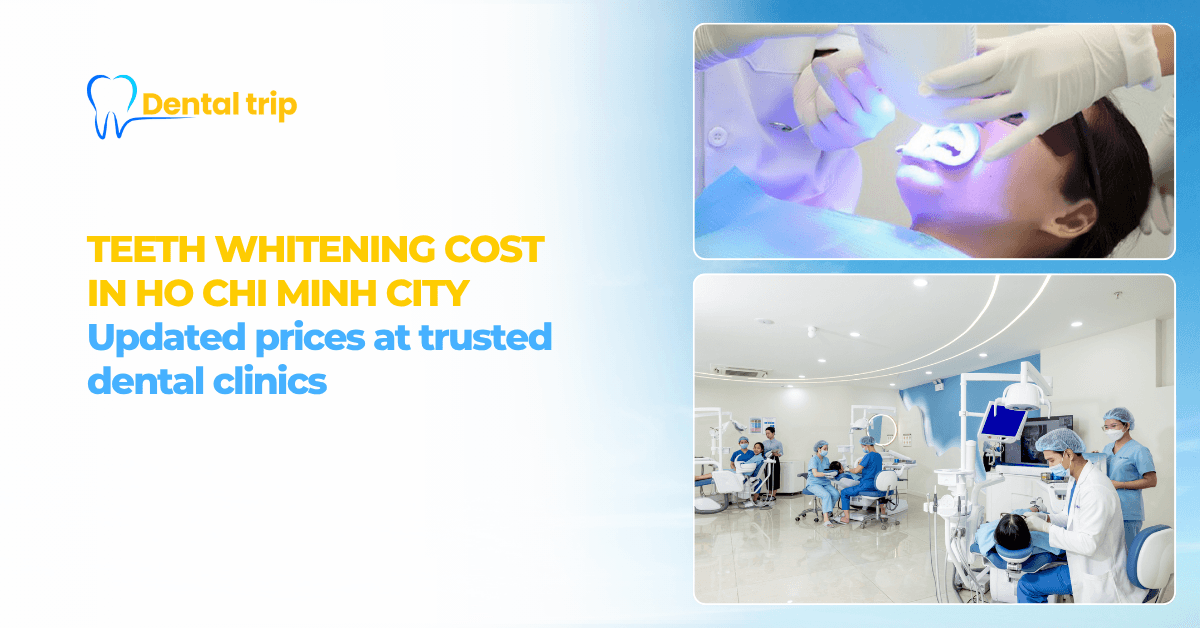 Teeth whitening cost in HCMC