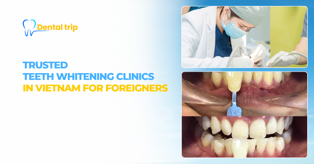 Trusted teeth whitening clinics in Vietnam for foreigners: Prices, safety and results