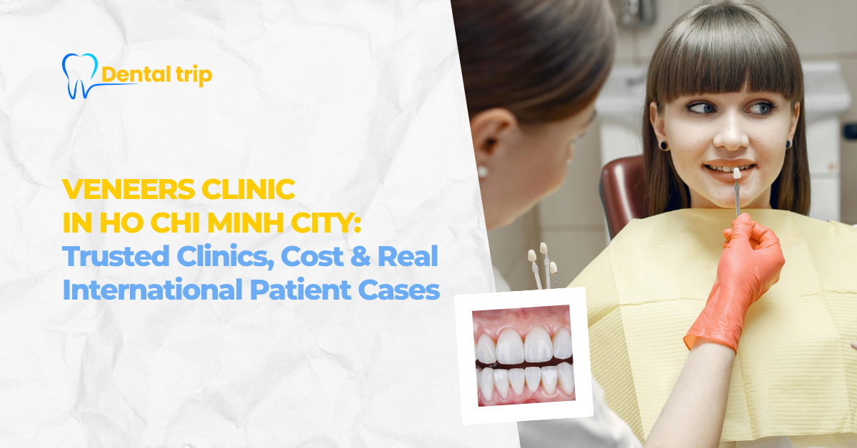 Veneers Clinics in Ho Chi Minh City