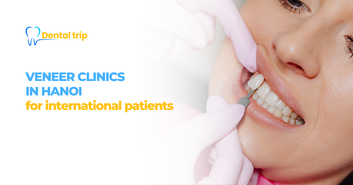 7 Trusted veneer clinics in Hanoi for international patients