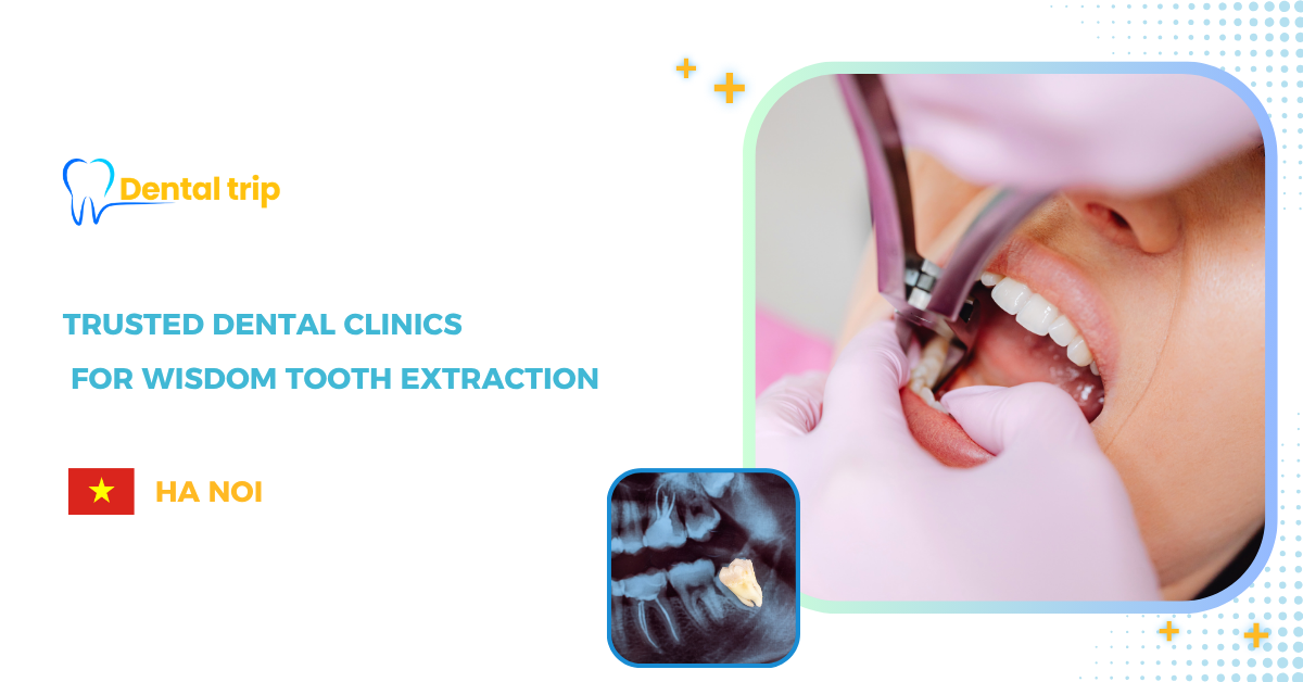 6 Reputable Dental Clinics for Wisdom Tooth Extraction in Hanoi