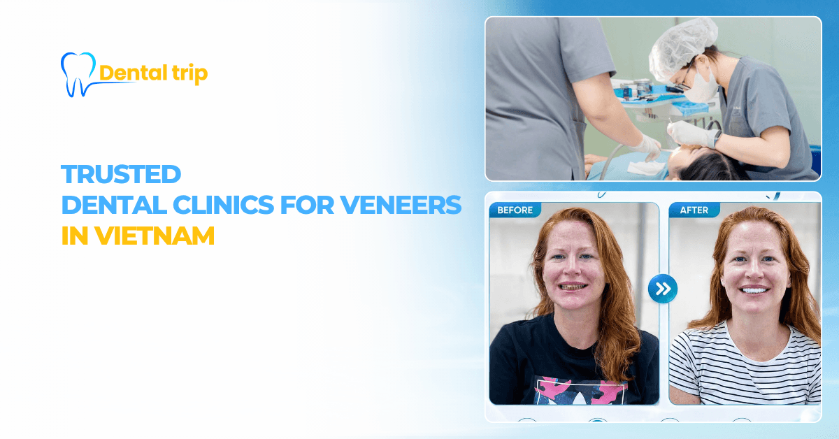 Trusted dental clinics for veneers in Vietnam