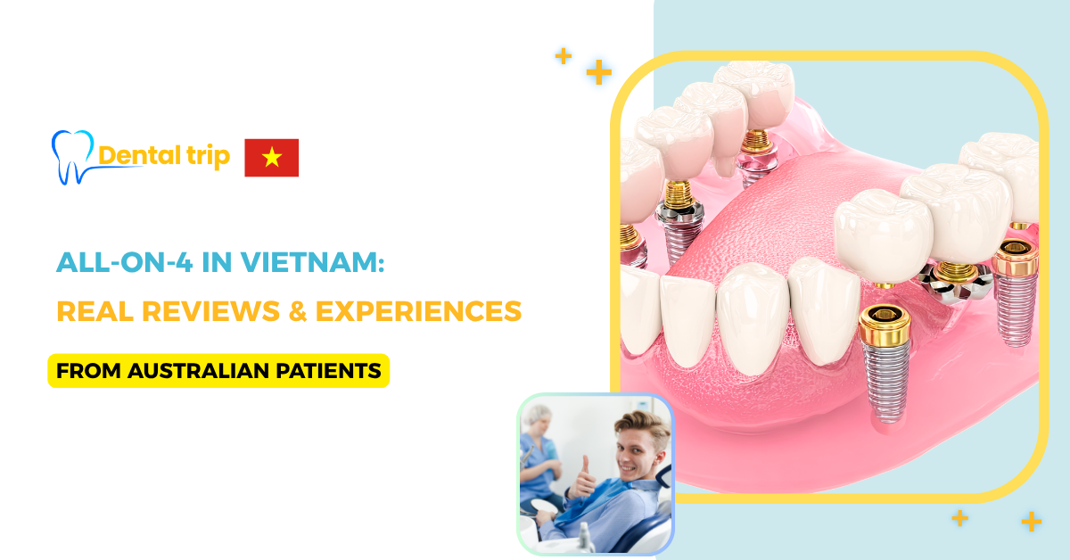 All-on-4 Vietnam Reviews from Australian Patients: Real Experiences & Results