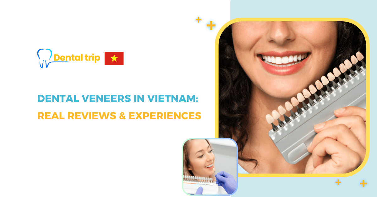 Porcelain Veneer in Vietnam Reviews