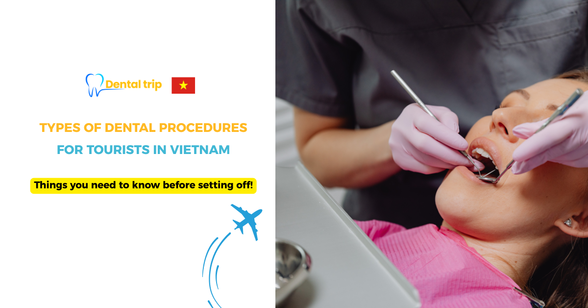 Types of Dental Procedures for Tourists in Vietnam