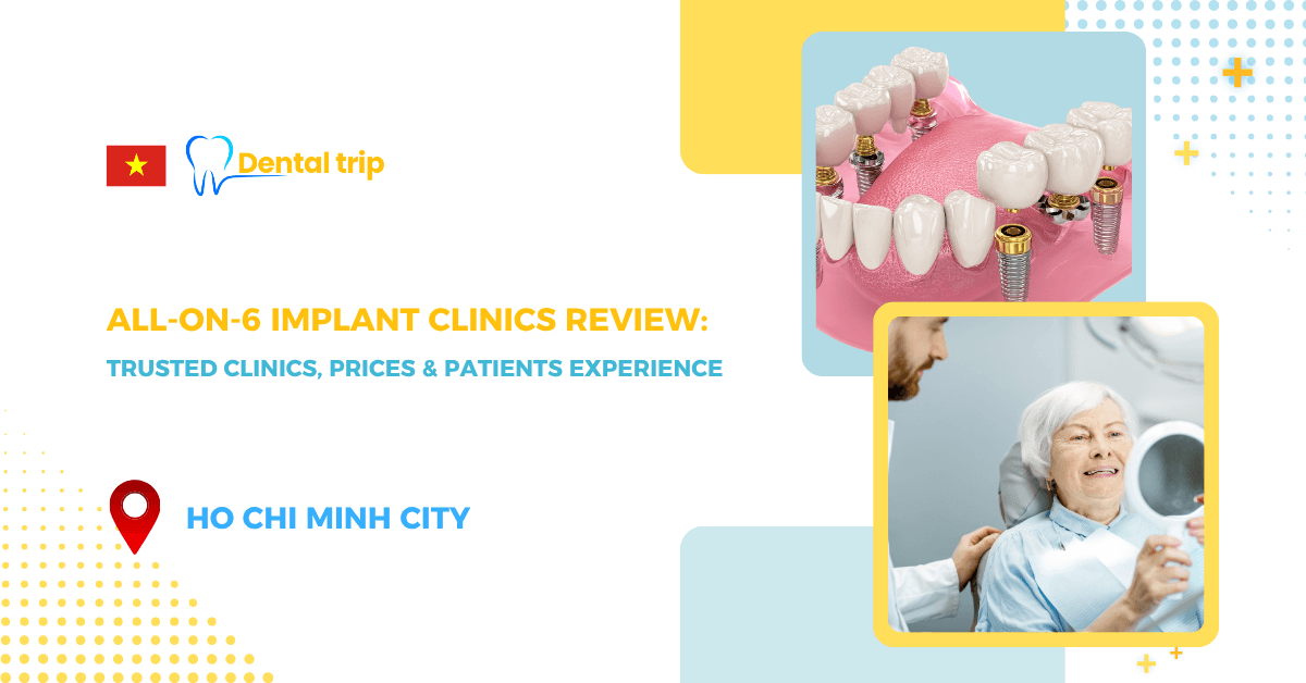 Review Trusted All-on-6 Dental Implant Clinics in HCMC 