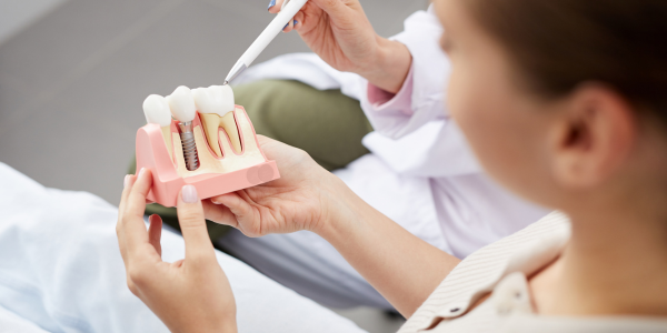 Dental Implants