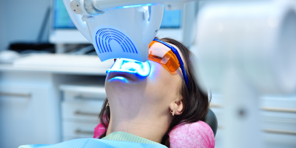 Teeth Whitening
