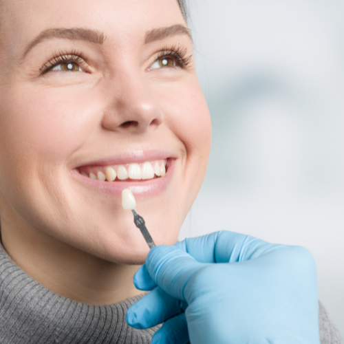 Dental Veneers