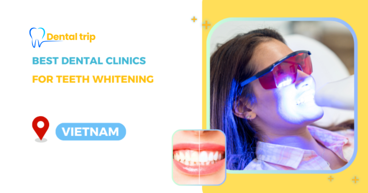 Professional teeth whitening for foreigners in Vietnam