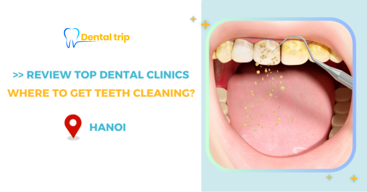Teeth cleaning dental clinic in Hanoi