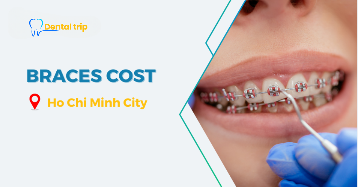 How much do braces cost in Ho Chi Minh City?