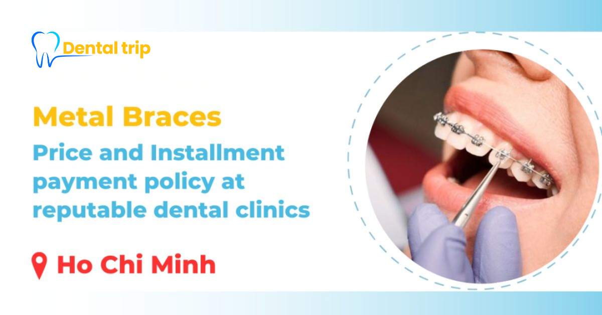 Installment payment policy for traditional metal braces in Ho Chi Minh City