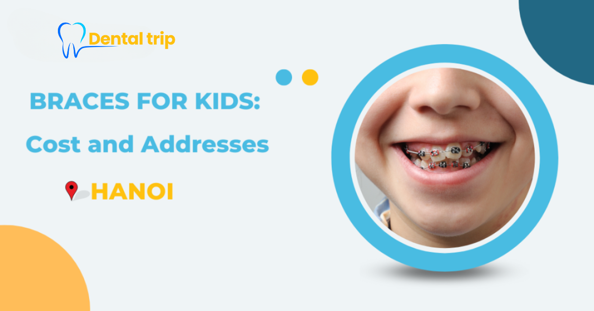 Braces for Kids in Hanoi: Detailed Prices at Trusted Dental Clinics