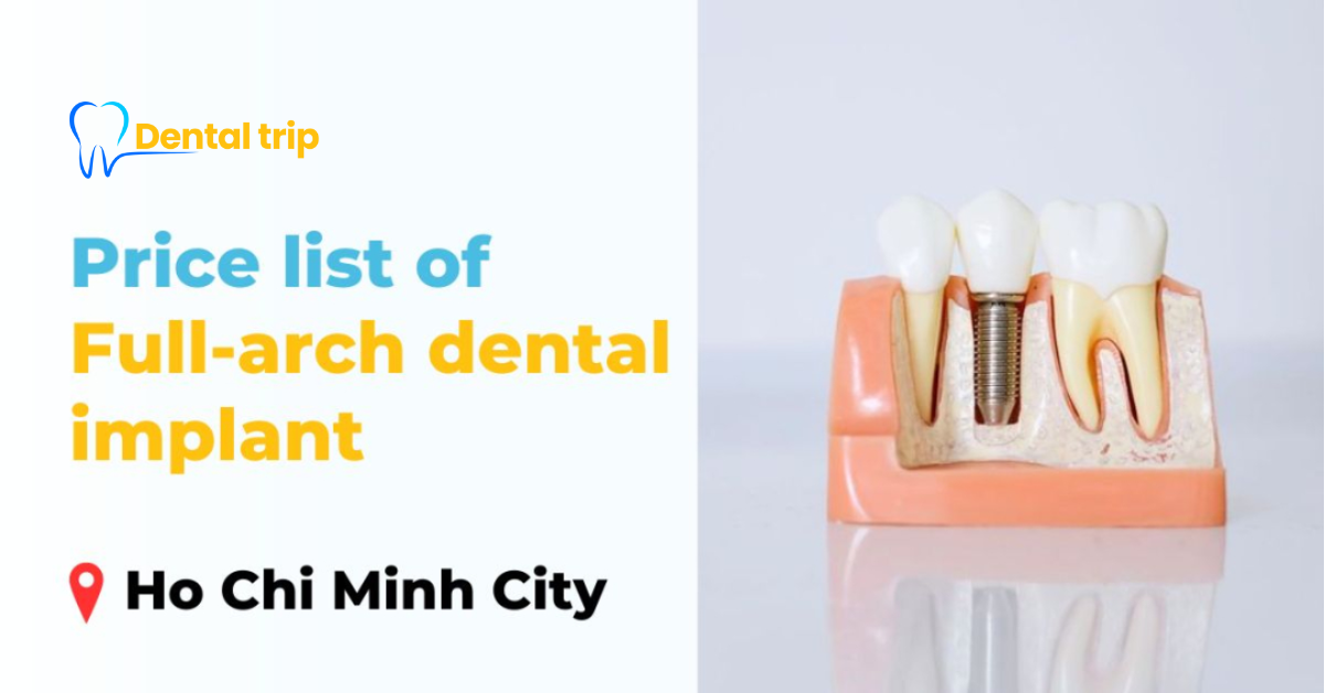 Full mouth dental implants cost in Ho Chi Minh City (2026 updated price list)