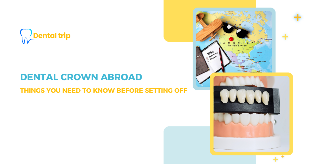 Dental crowns abroad in 2026: A smart traveller’s guide to saving big without sacrificing quality