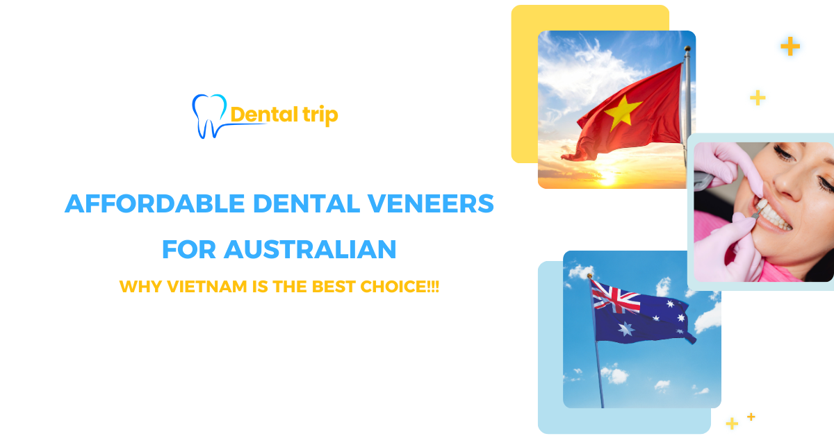 Affordable dental veneers for Australians: Why Vietnam is a top destination!