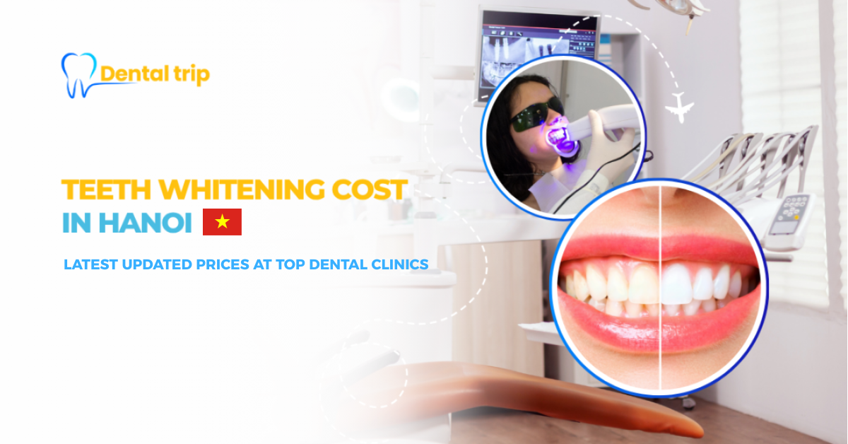 How much does teeth whitening cost in Hanoi?