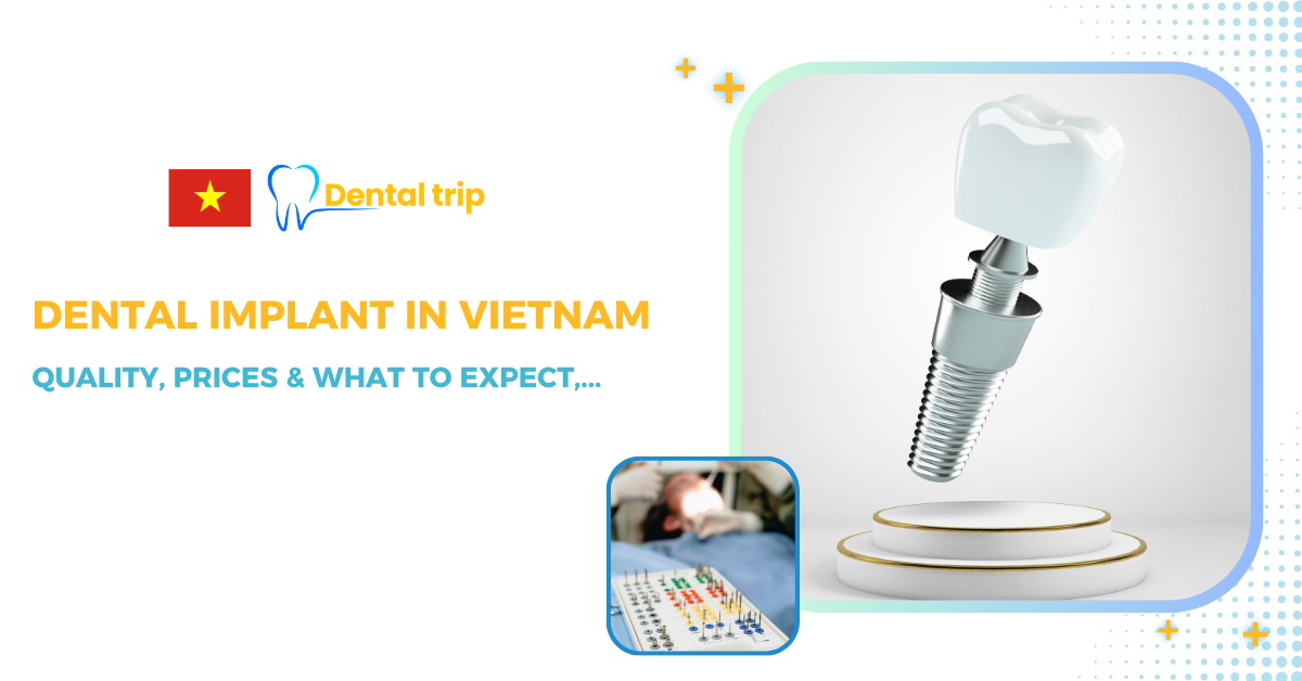 Dental Implants in Vietnam: A Complete Guide for International Patients