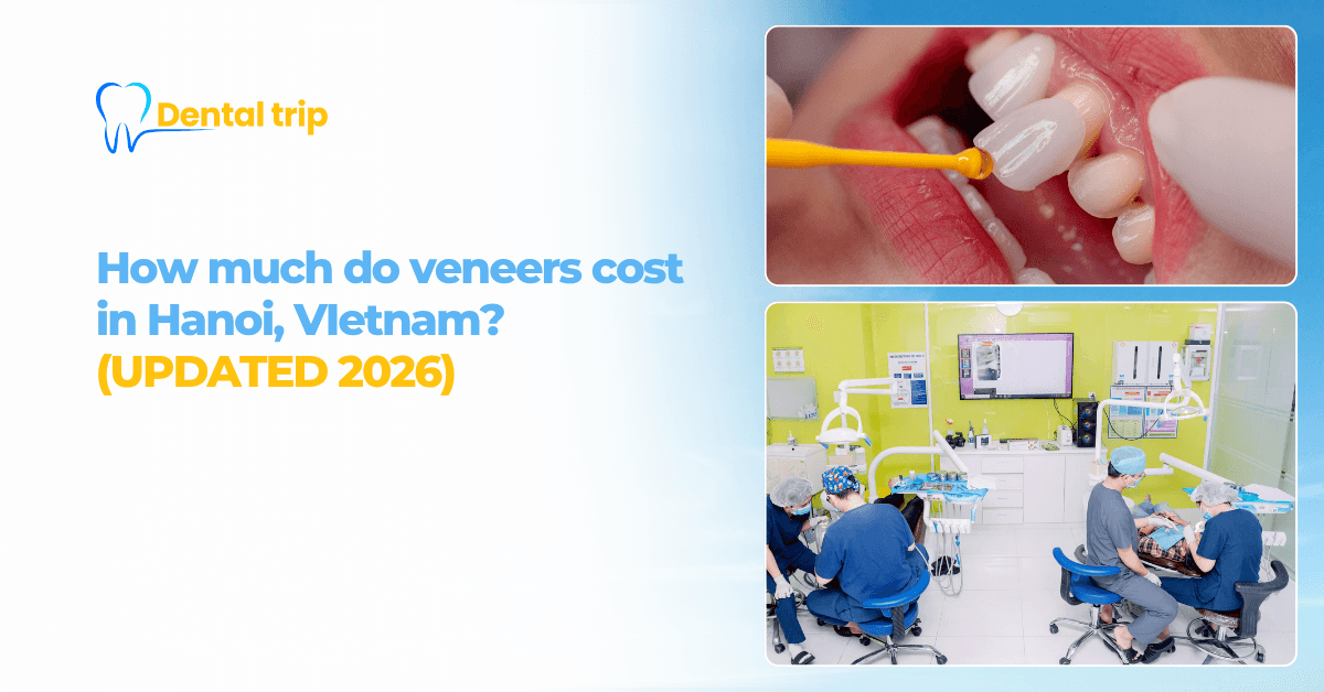 Veneers cost in Hanoi, Vietnam (2026): Prices, types & dental tourism guide