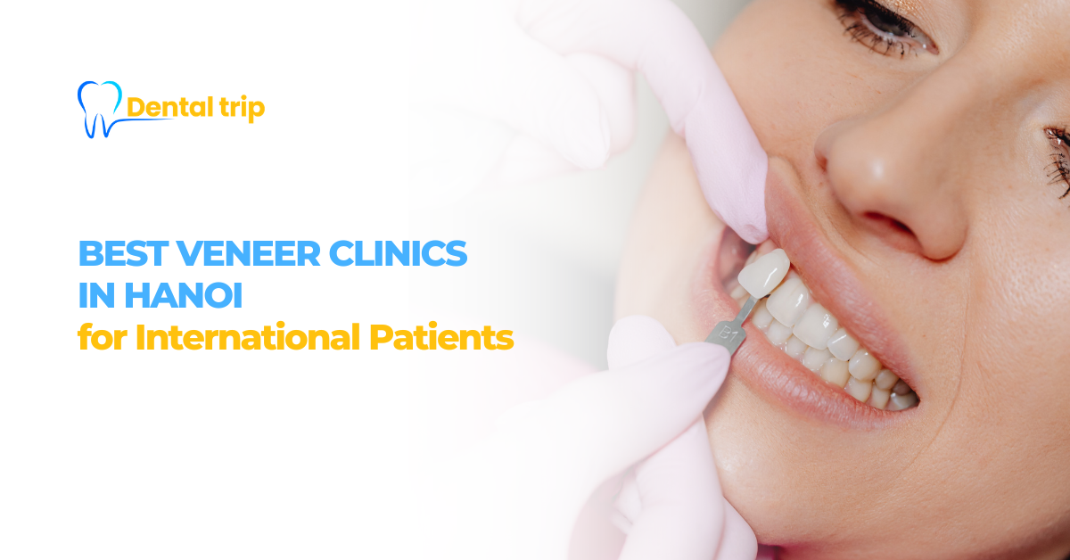 best veneers Hanoi