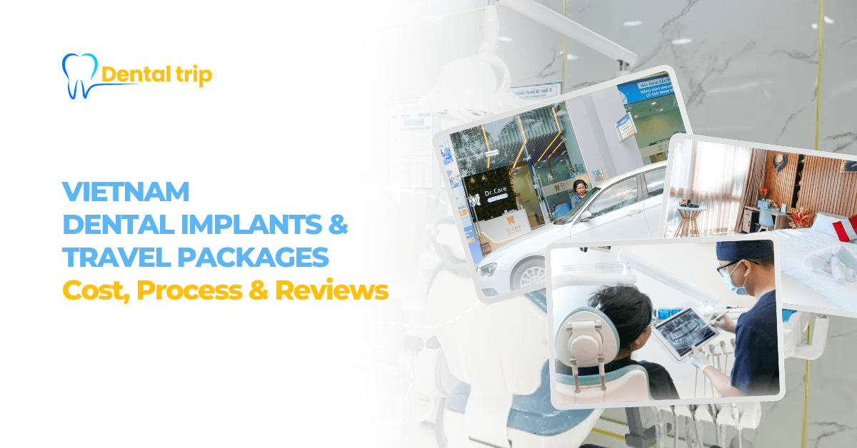Vietnam dental implants and travel packages: Cost, process & reviews