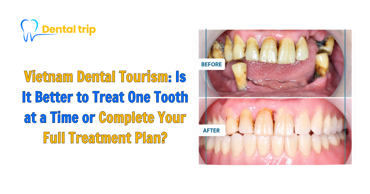 Vietnam dental tourism
