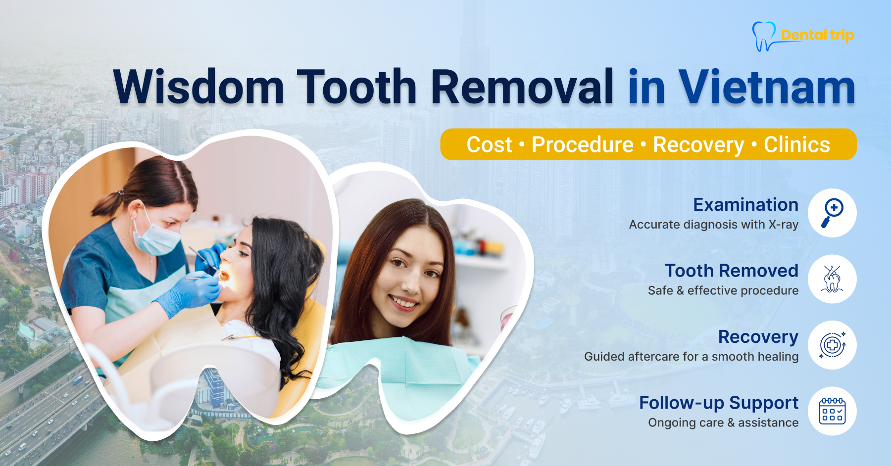 Wisdom tooth removal in Vietnam