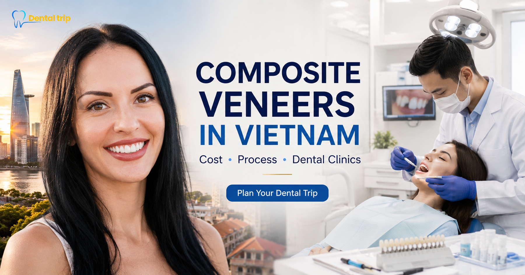 Composite veneers in Vietnam