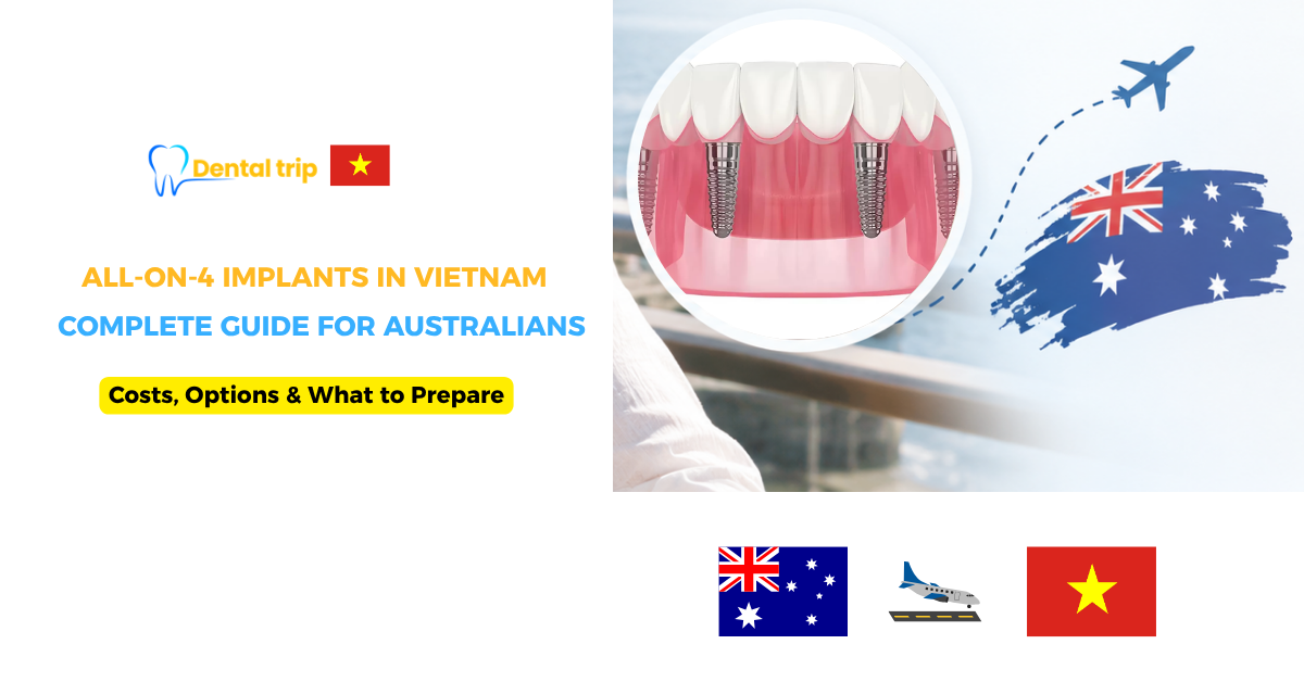 Complete Guide to All-on-4 Dental Implants in Vietnam for Australians