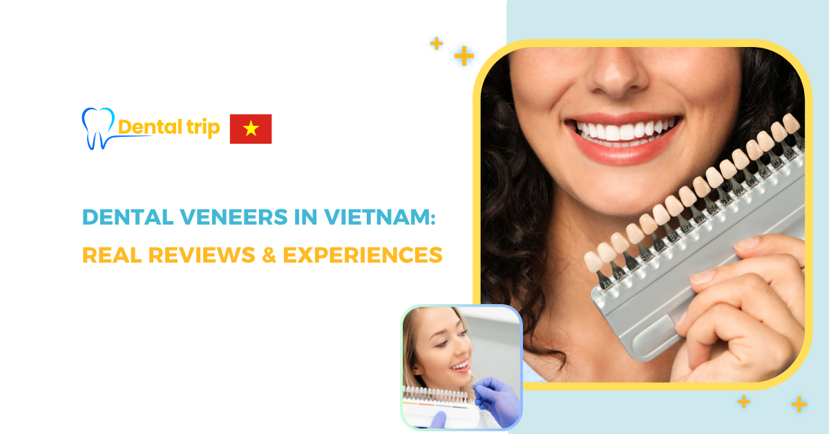 Porcelain Veneer in Vietnam Reviews
